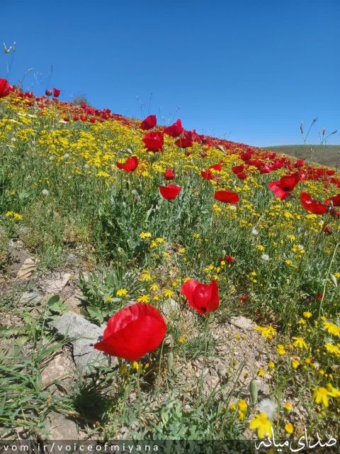 تصویر صدای میانه